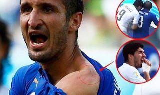 世界杯红牌停赛几场